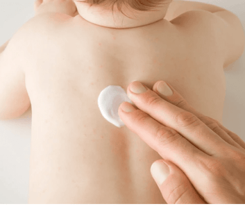 Aichun Beauty - Baby Care Nappy Rash Cream (Original)