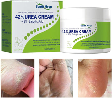 South Moon - 42% Urea Cream + 2% Salicylic Acid (Original)
